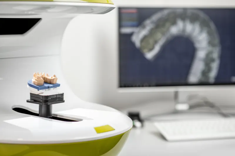 Dental model on a laboratory 3D scanner with the scan shown on screen