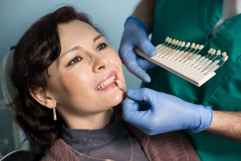 Clinician holding a shade guide beside a patient's teeth to match tooth color